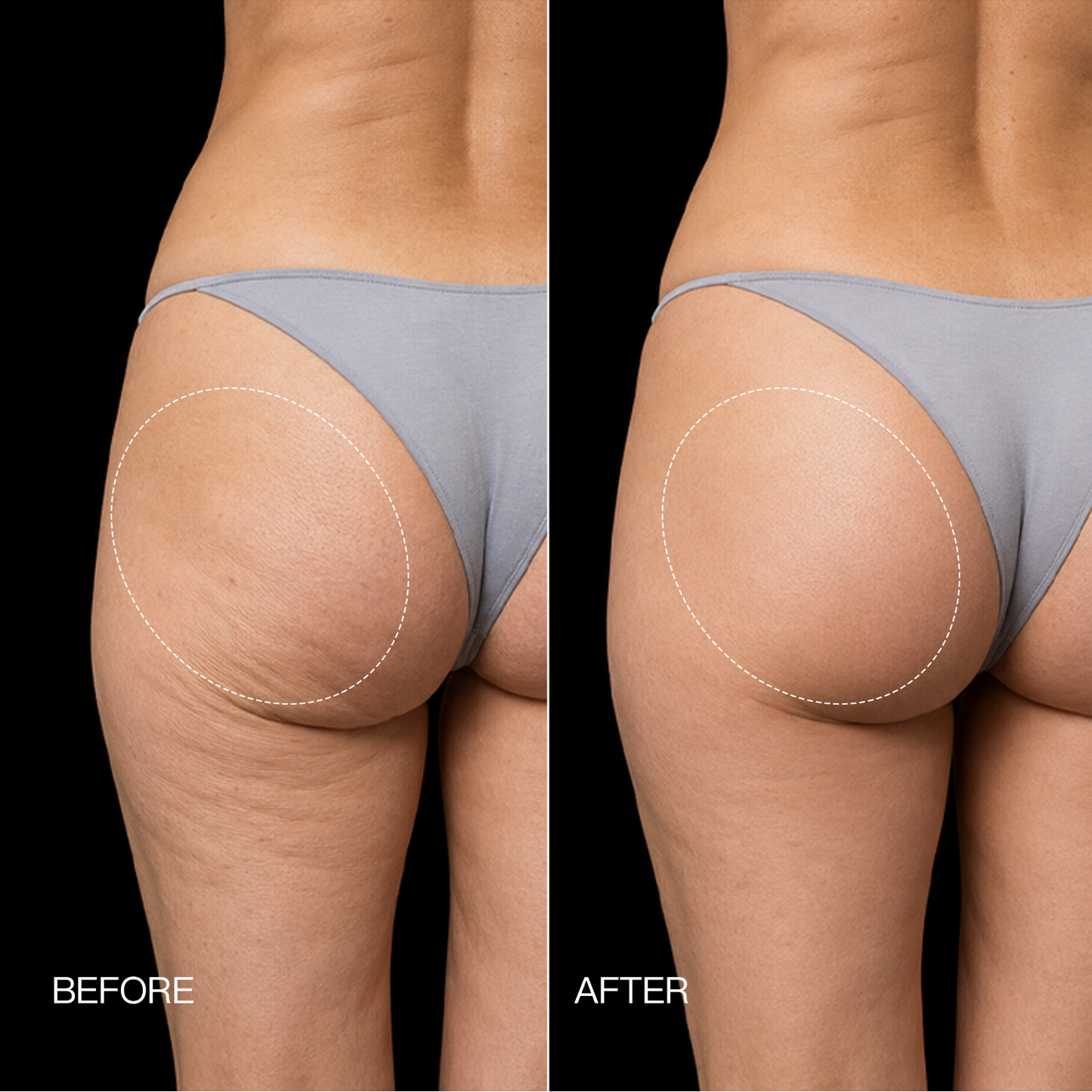 PulseFit™ EMS Toning Shorts