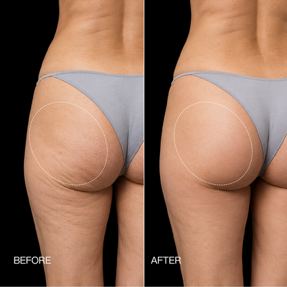 PulseFit™ EMS Toning Shorts