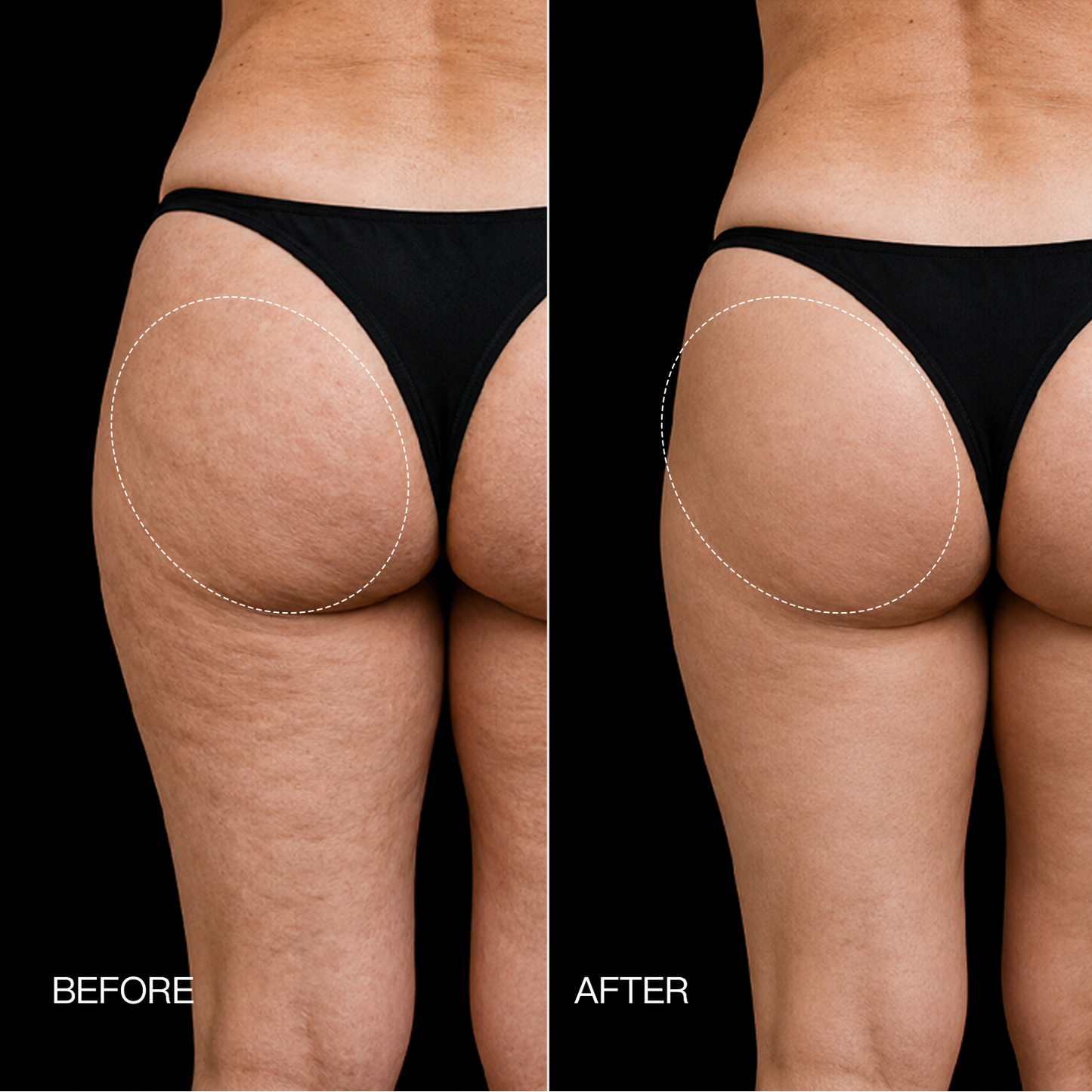 PulseFit™ EMS Toning Shorts